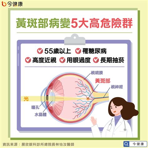 眼睛有斑|黃斑部是什麼？認識黃斑部病變症狀、治療到術後護理與保養